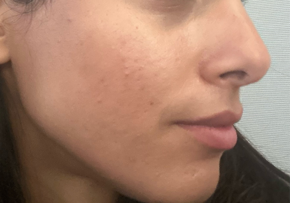 image comparison after